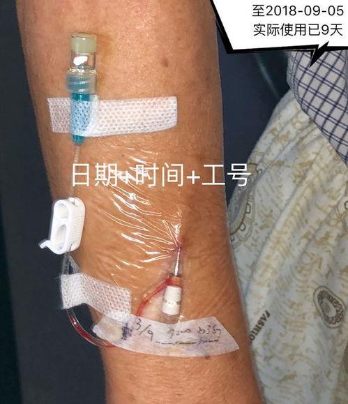 国产留置针穿刺视频老人,关爱老人，守护健康